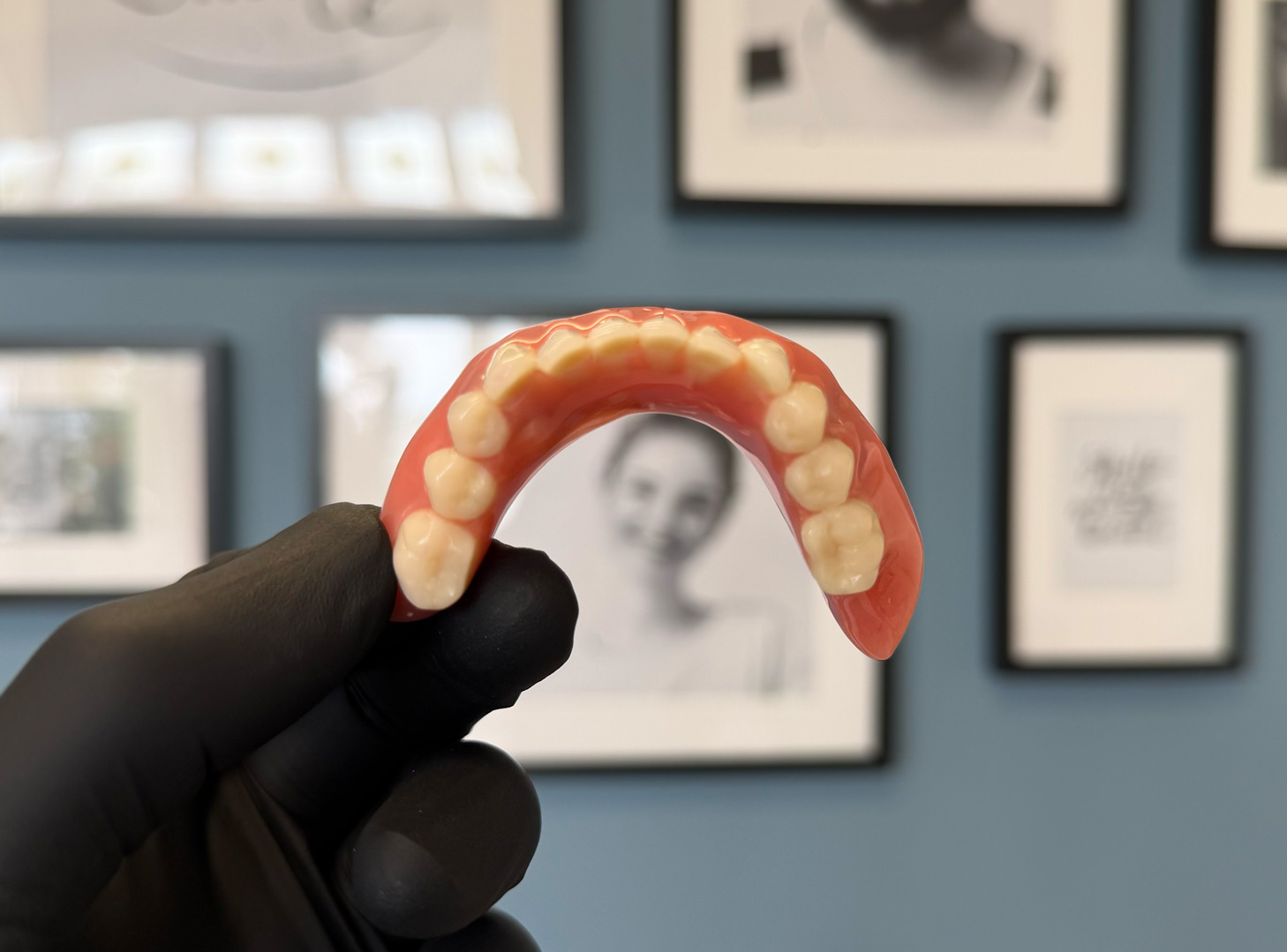 Custom-made denture at Bespoke Dental, Malahide