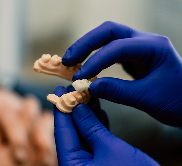 Close-up of a completed dental bridge